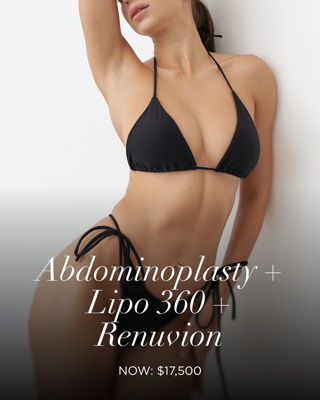 Abdominoplasty + Lipo 360 + Renuvion Special
