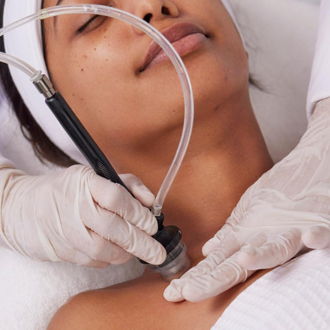 DiamondGlow treatment