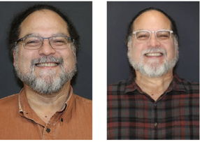TMD Therapy before & after 3