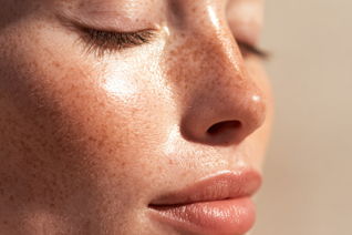 Save on Botox at Avelure Med Spa
